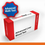 Liver Blood Test Guide for Residents of Birmingham