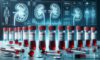 Kidney Blood Test Guide for Blackburn Residents