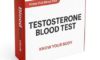 Testosterone Blood Tests: Their Importance in Guildford